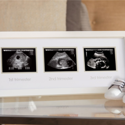 Marco ecografía trimestral - Imagen 2
