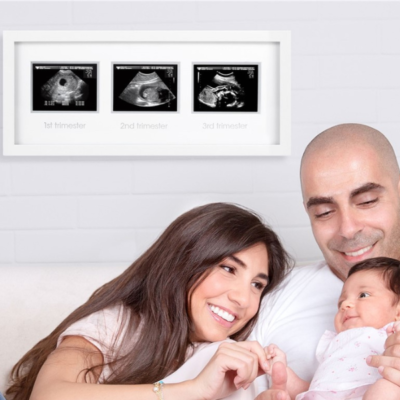 Marco ecografía trimestral - Imagen 3