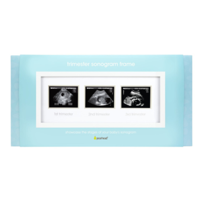 Marco ecografía trimestral - Imagen 5